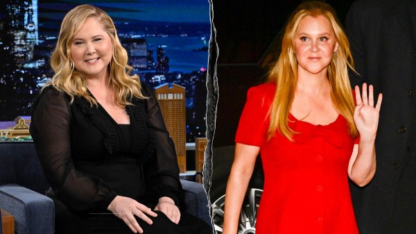 What to know about Cushing&rsquo;s syndrome, which led to Amy Schumer's dramatic weight loss