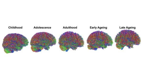 Your brain doesn’t age the way you think — new research upends old beliefs