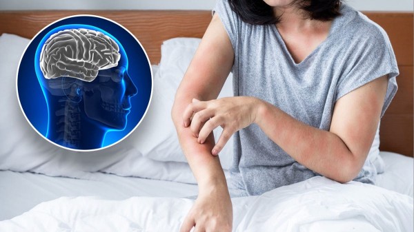 Lower dementia risk linked to routine vaccination in major new analysis