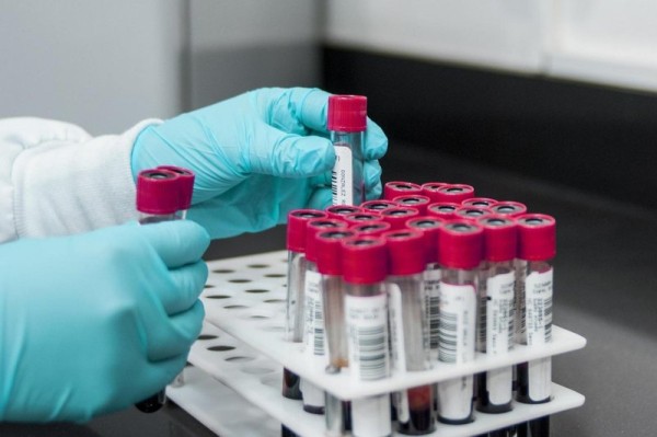 Millions of Abbott glucose sensors recalled after faulty readings