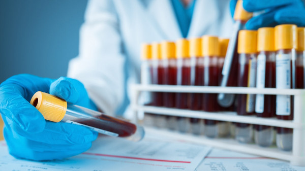 Common nighttime noise exposure may trigger heart problems, study suggests Common nighttime noise exposure may trigger heart problems, study suggests