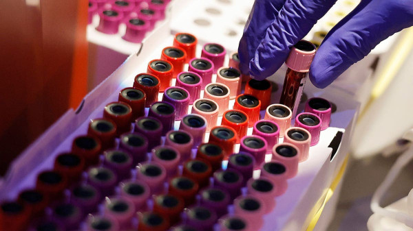 Jalen Hurts puts spotlight on blood thinners: 5 mistakes that could put patients at risk Jalen Hurts puts spotlight on blood thinners: 5 mistakes that could put patients at risk