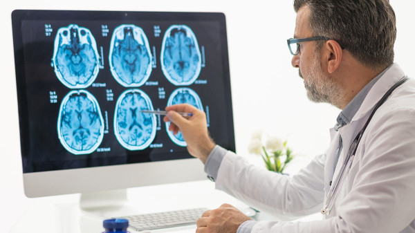 Popular foods Americans eat every day linked to silent brain damage, alarming study finds Popular foods Americans eat every day linked to silent brain damage, alarming study finds
